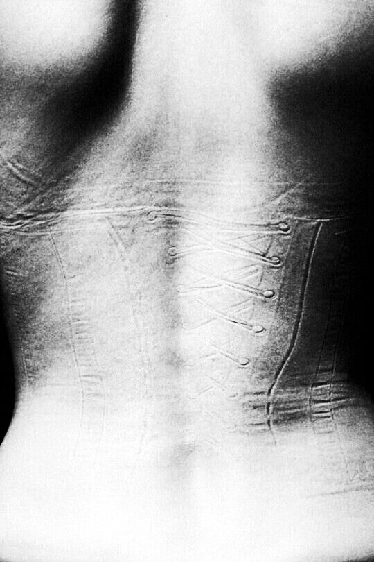 the image is a striking black and white photograph depicting the back of a woman's torso.  the most prominent feature is the clear impression of a corset left on her skin, showing the lacing pattern and the shape of the garment. the lines of the corset imprint are deeply etched into the skin, suggesting prolonged wear. the contrast between light and shadow emphasizes the texture of the skin and the details of the corset marks. the overall mood is stark, evocative, and slightly unsettling, hinting at themes of body modification, historical fashion, and the constraints of societal expectations.