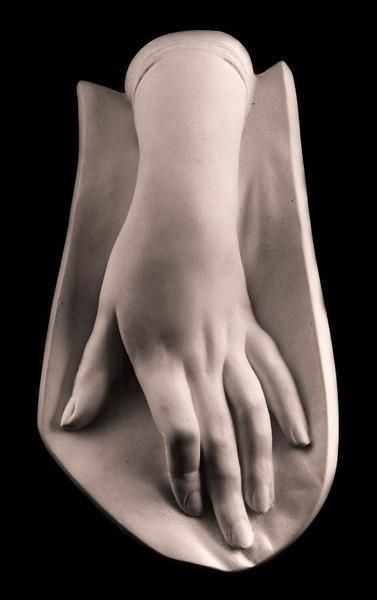 a plaster cast of a hand and forearm is set against a black background. the hand is open and relaxed, with the fingers slightly curved. the forearm emerges from a molded form, creating a sculptural effect.