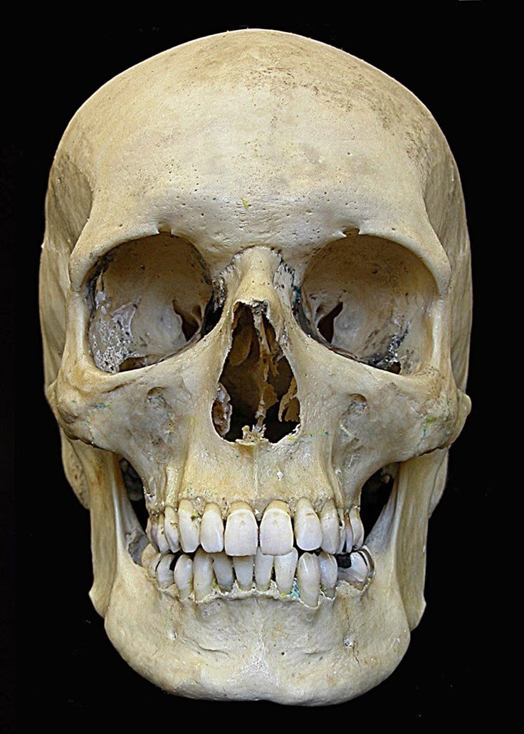 a closeup view of a human skull, showing the detail of the cranium, mandible, and teeth. the skull is isolated against a black background.
