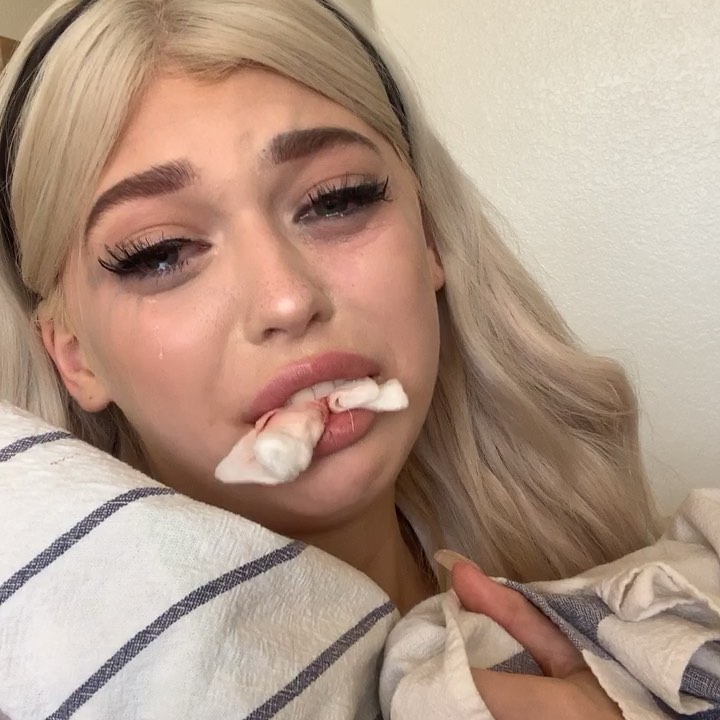 a closeup image shows a young woman with blonde hair and a black headband, crying with tears visible on her face. she is holding a piece of cotton gauze in her mouth, suggesting a possible dental procedure or injury causing bleeding. she's holding a striped pillow or fabric. the woman's makeup is smudged, further emphasizing her distress.