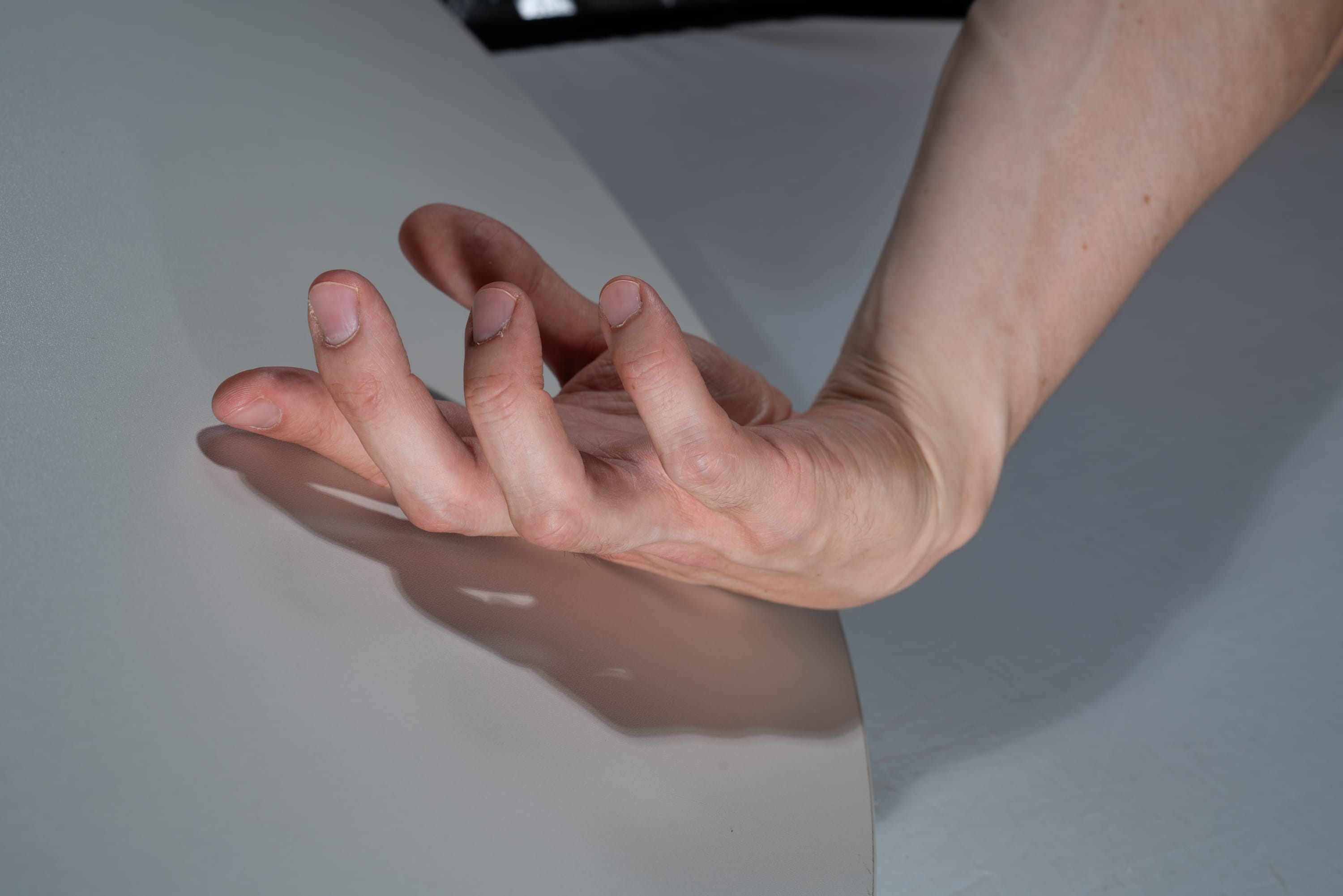 the image shows a closeup view of a hand, with fingers slightly curled, resting on a smooth, white surface. the skin is pale and the lighting is soft, creating a neutral backdrop that emphasizes the details of the hand.