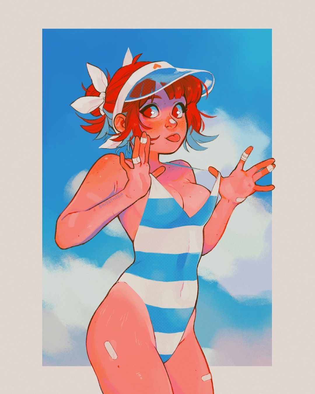 a young woman with sunburn is standing in a blue and white striped bathing suit. she has red hair pulled back with a white scrunchie and is wearing a white visor. she has bandaids on her shoulders, fingers and leg. the background is blue sky and white clouds.