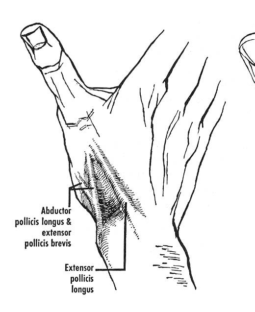 a labeled diagram depicting the muscles on the back of the hand, including the abductor pollicis longus, extensor pollicis brevis, and extensor pollicis longus.