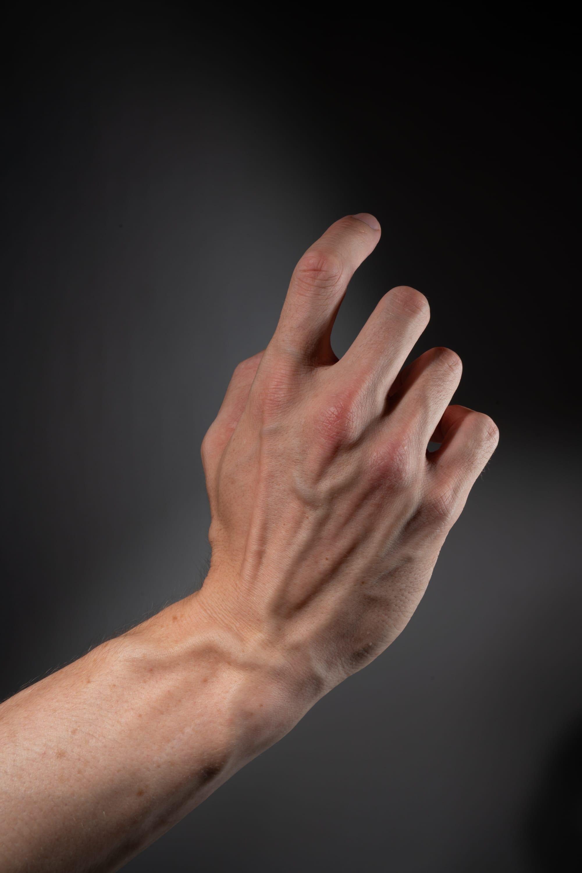 a closeup side view of a fairskinned male left hand is posed against a dark gray background in a studio setting with studio lighting. the index finger is extended straight up while the other fingers are relaxed. the hand exhibits visible veins.