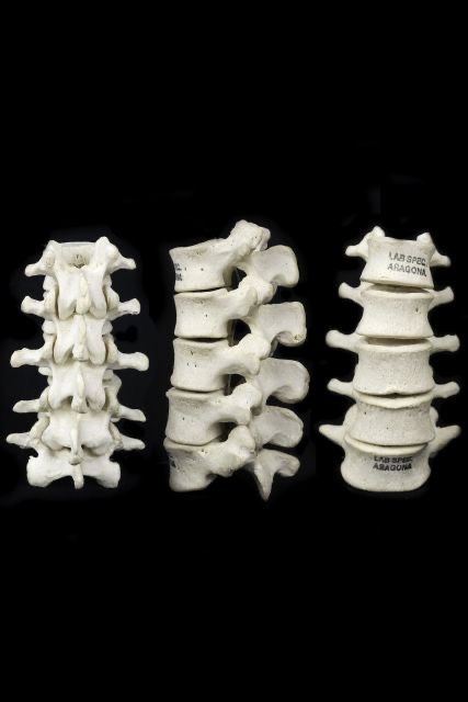 three different views of sections of the human spine on a black background.