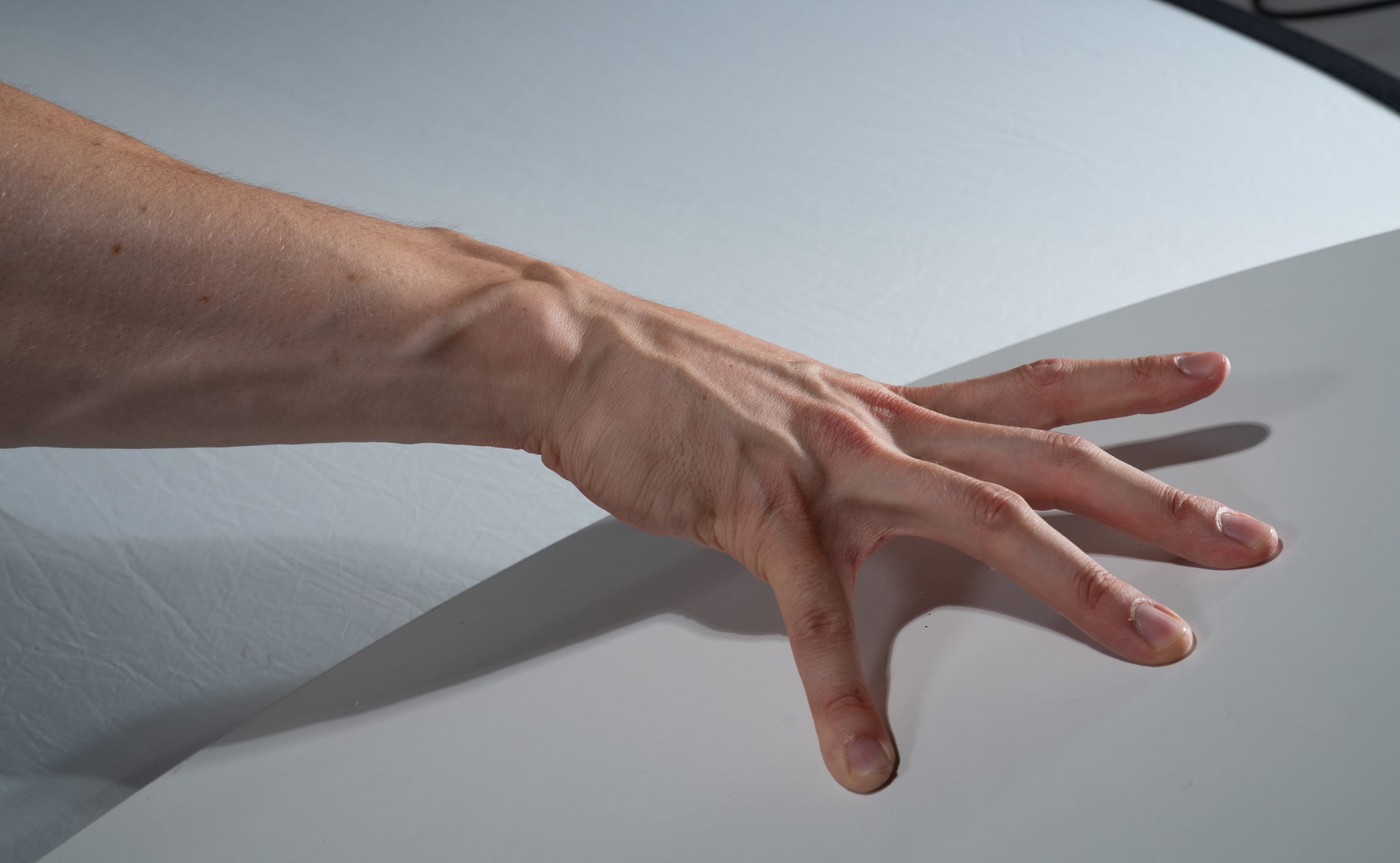 the image showcases a closeup view of a person's hand and forearm, prominently displaying the intricate network of veins beneath the skin. the hand is outstretched, fingers splayed, against a smooth white backdrop illuminated by artificial studio lighting. this perspective emphasizes the anatomical details of the hand, highlighting the texture and coloration of the skin, as well as the pronounced visibility of the veins.