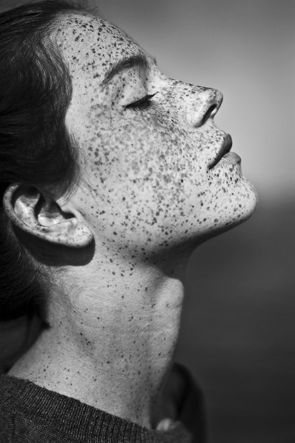 a black and white closeup portrait of a woman's face in profile, showcasing her prominent freckles covering her face and neck. she has her eyes closed and her head tilted back, seemingly enjoying the sunlight. the image highlights the natural beauty of her skin and features.