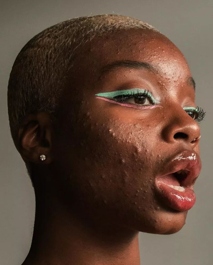 a closeup side profile of a woman with dark skin and short blonde hair. she is wearing winged eyeliner in pink and turquoise and has glossy lips. her skin has acne. she has an earring and a nose ring. her mouth is open.