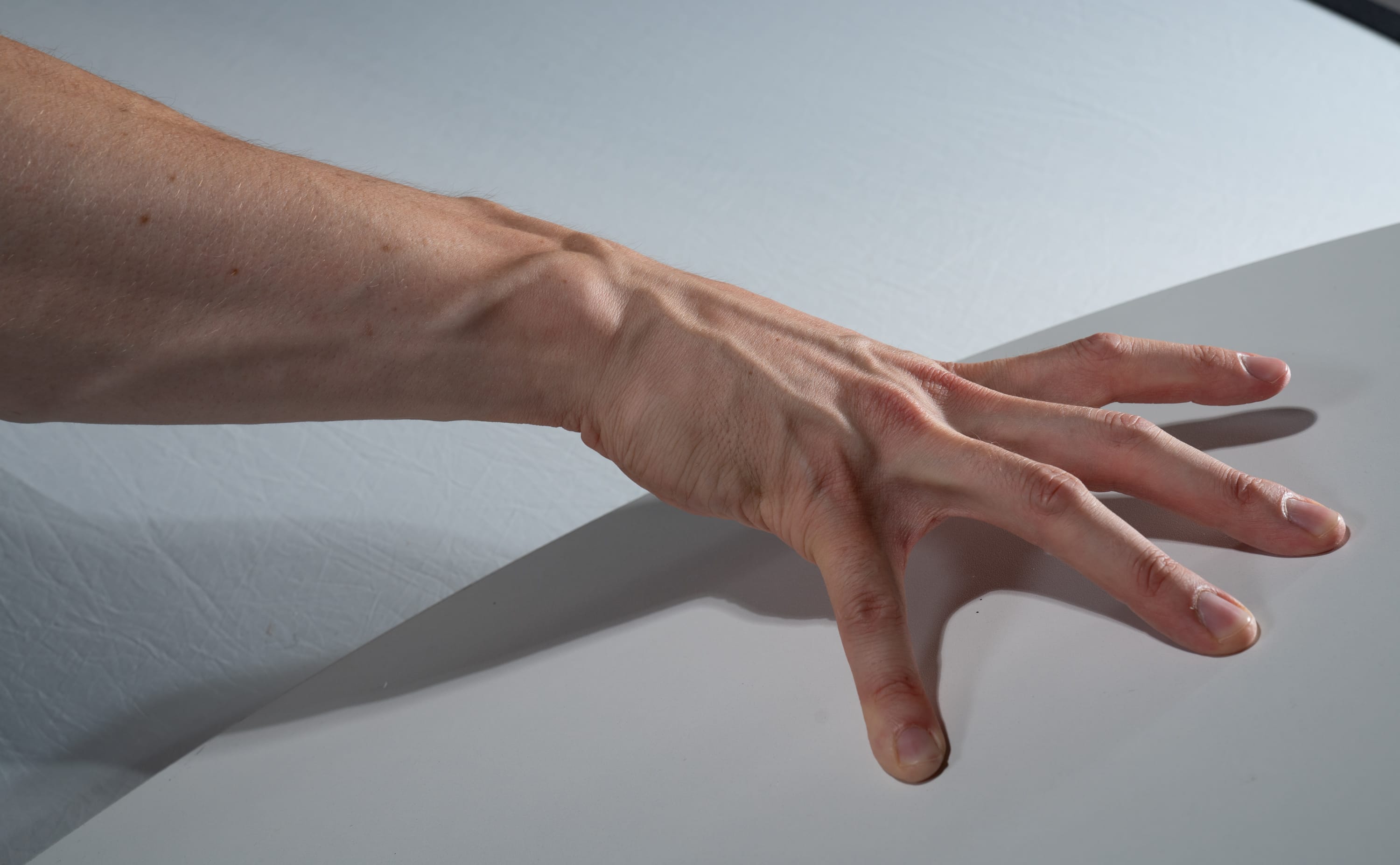 a closeup photo of an arm and hand resting on a white surface, illuminated by studio lighting. the image highlights the details of the skin, veins, and fingers.