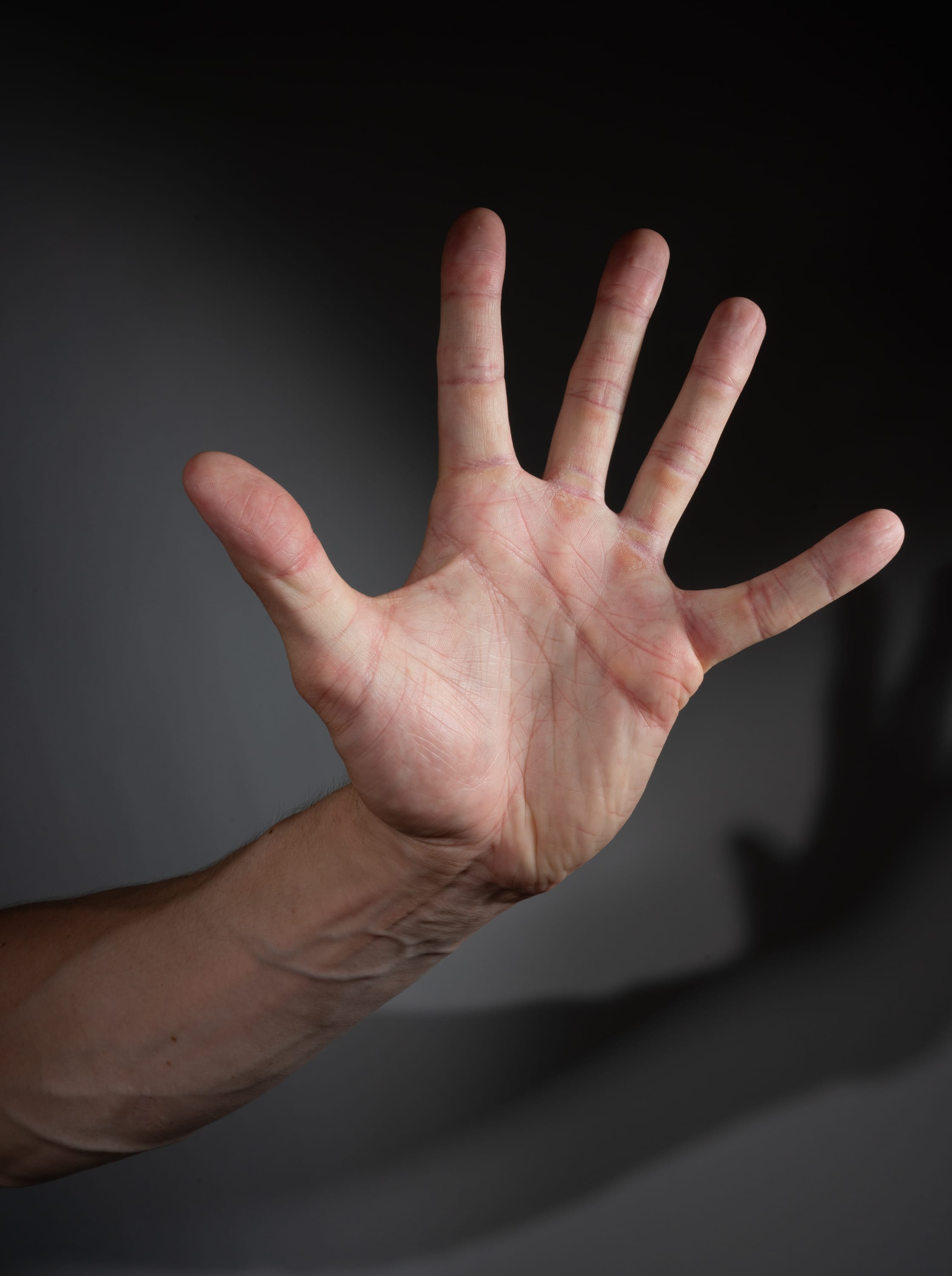 a male left hand is shown with fingers splayed