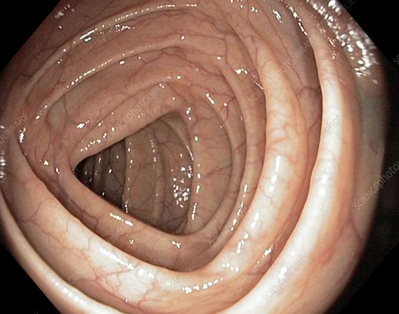 a close up view of the inside of the small intestine. the walls are pink and smooth with visible blood vessels. this image was taken during an endoscopy procedure.