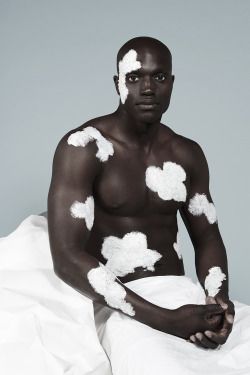 a man with vitiligo, a skin condition that causes loss of pigmentation, is sitting on a white sheet. he is barechested and has white patches on his skin. he is looking at the camera with a serious expression. the background is white.