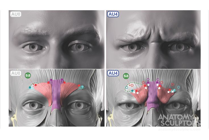 the image presents a 3d model of a man's face divided into four sections. the top row displays two neutral expressions labeled au0 and au4, subtly differing in eyebrow positioning. the bottom row reveals the underlying facial muscle structure corresponding to the expressions above. highlighted in color are the corrugator supercilii and procerus muscles, responsible for furrowing the brows. specifically, au4 illustrates their contraction, showcasing a more pronounced frown compared to au0. this visual aids in understanding how specific facial muscles contribute to conveying various emotions.