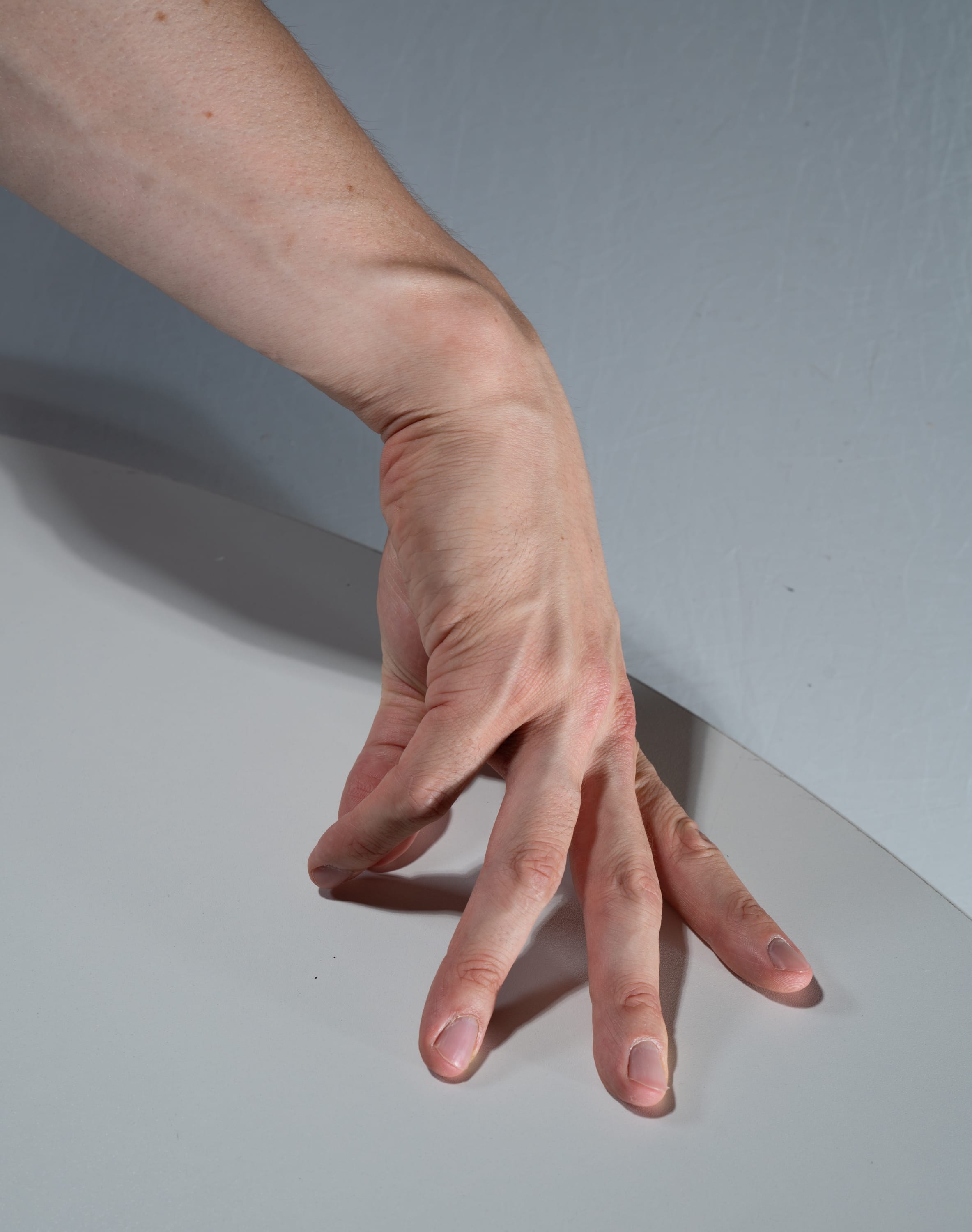 a hand is sprawled out on a white table, illuminated by studio lighting. the perspective is closeup, highlighting the details of the skin and veins.