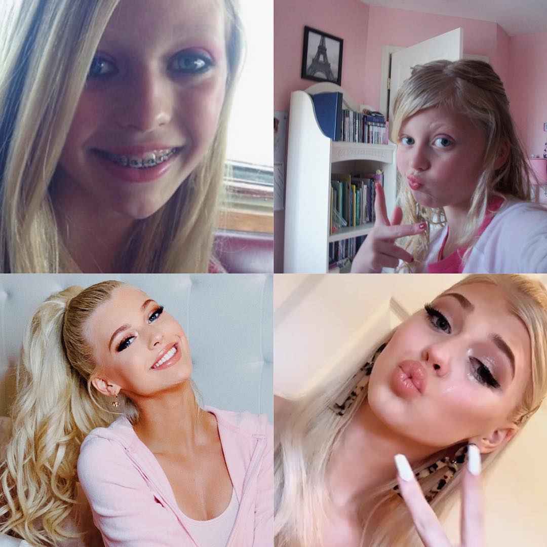 a collage image showing a woman named loren gray growing up from a child with braces to an adult with makeup and earrings.