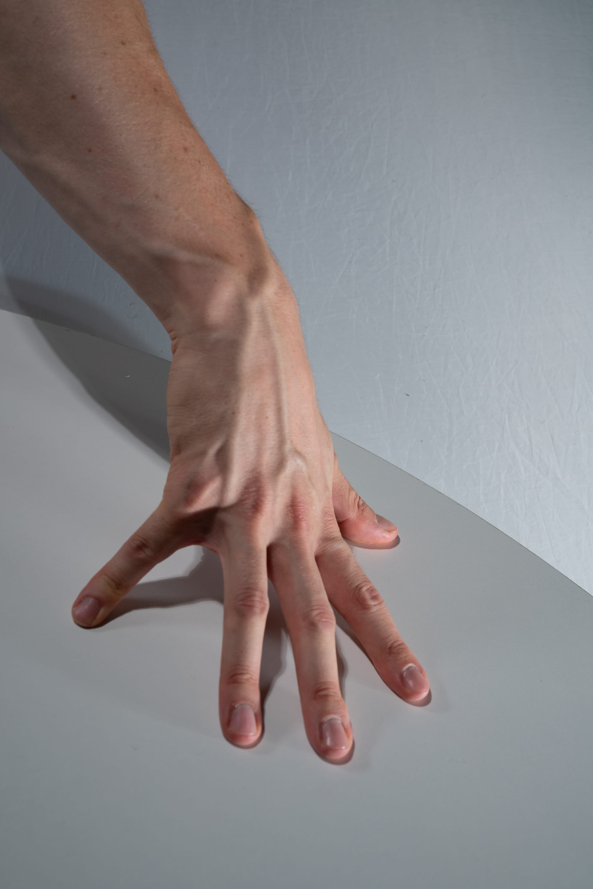 a closeup shot of a person's hand and arm resting on a white surface. the hand is outstretched with the fingers slightly spread. prominent veins are visible on the back of the hand and arm, highlighted by the studio lighting. the background is a smooth, light gray wall.
