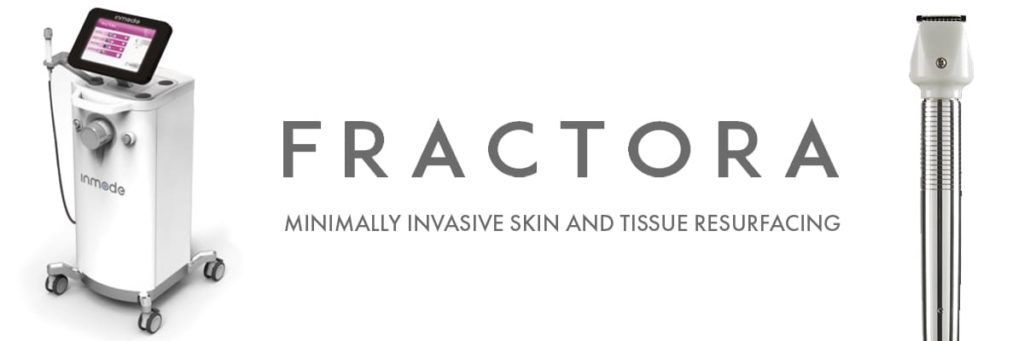 Fractora featured image