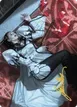 Deadly Complication #18