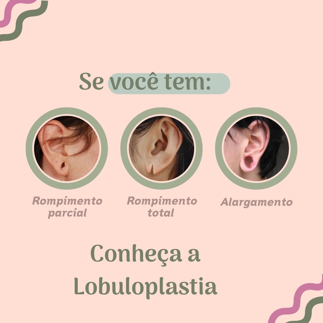 post imagem