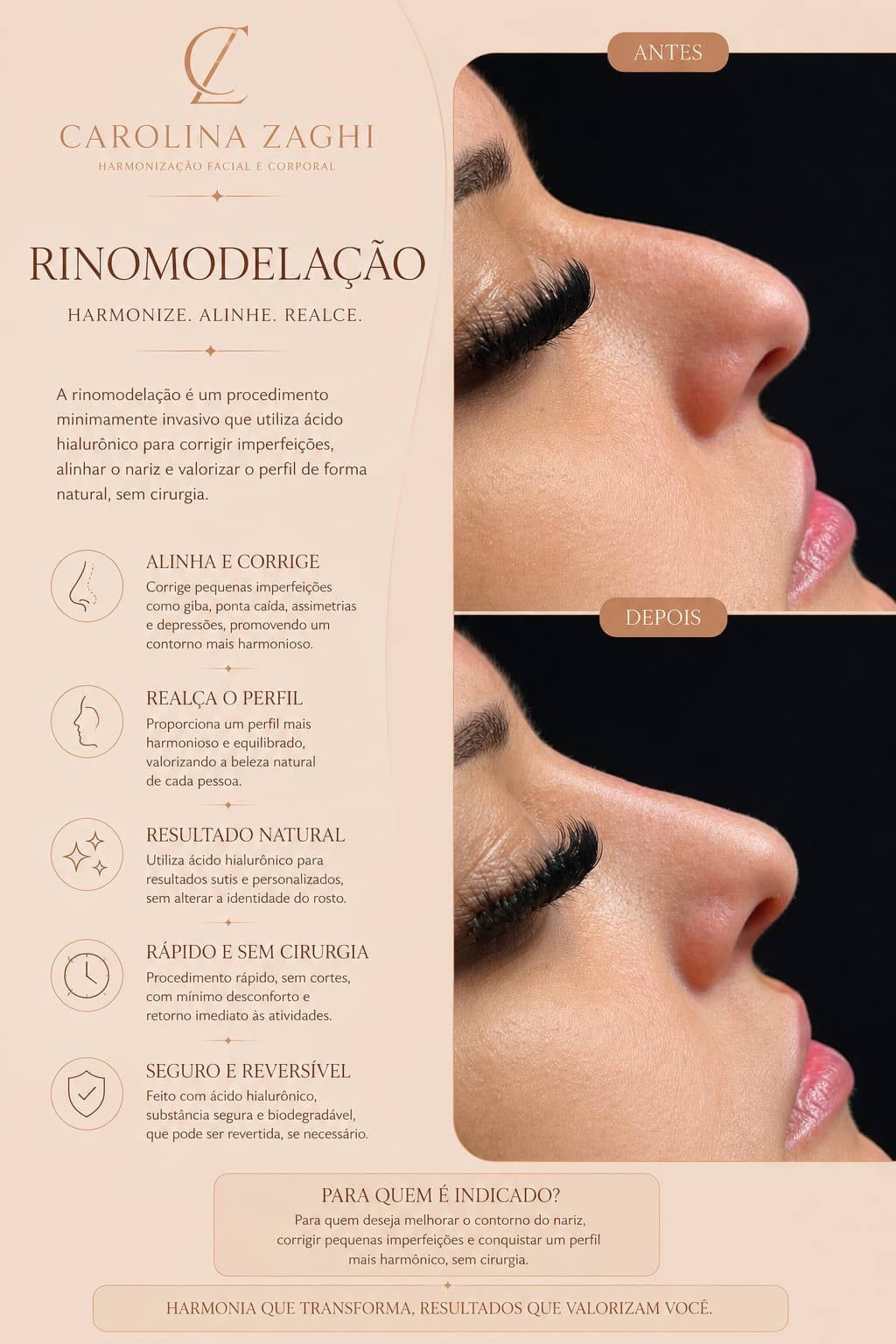 post imagem