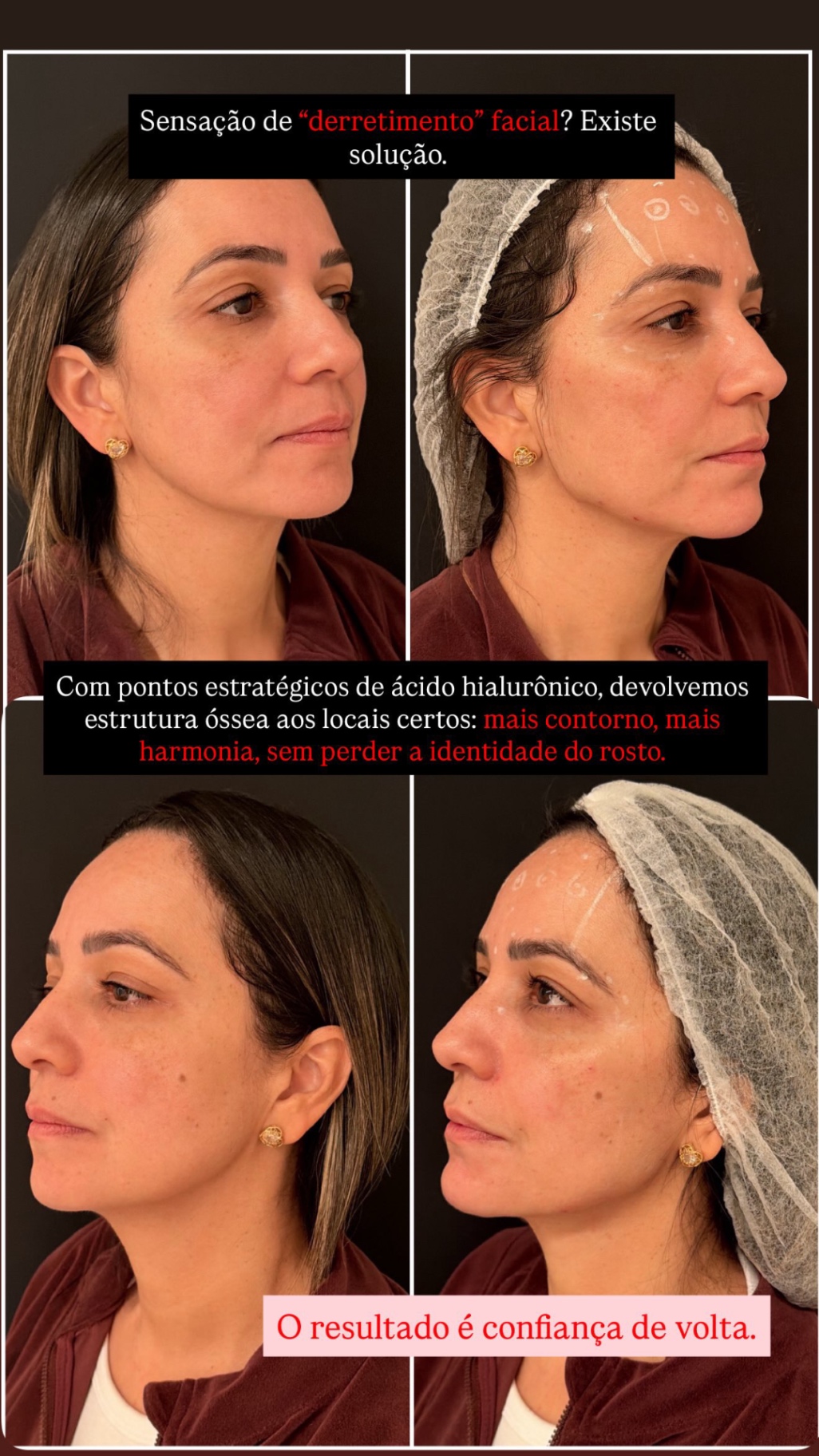 post imagem