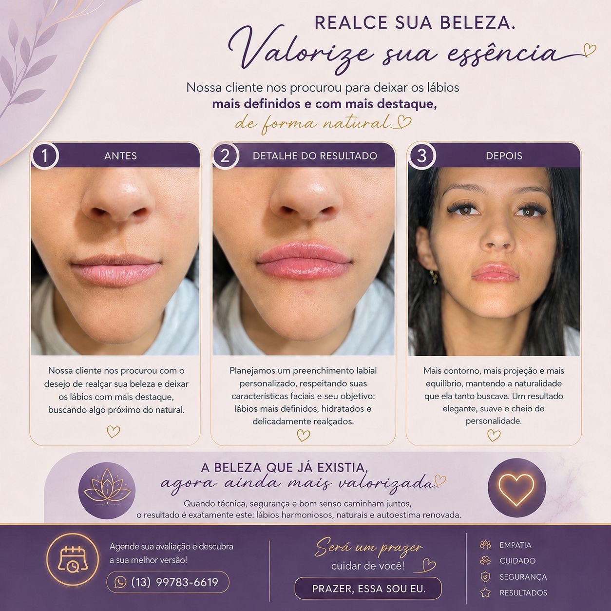 post imagem