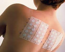 Patch Teste - Teste de contato de bateria padrão mais cosméticos | Clínica  CamargoClínica Camargo