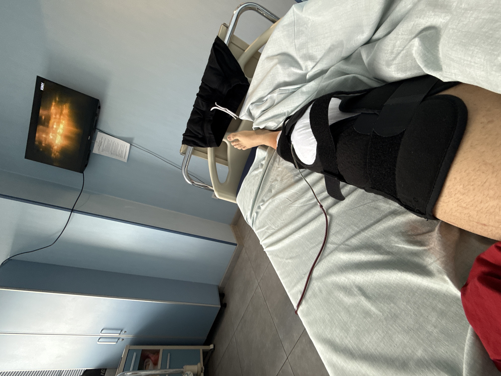 Patient recovering with knee brace in Sofia hospital