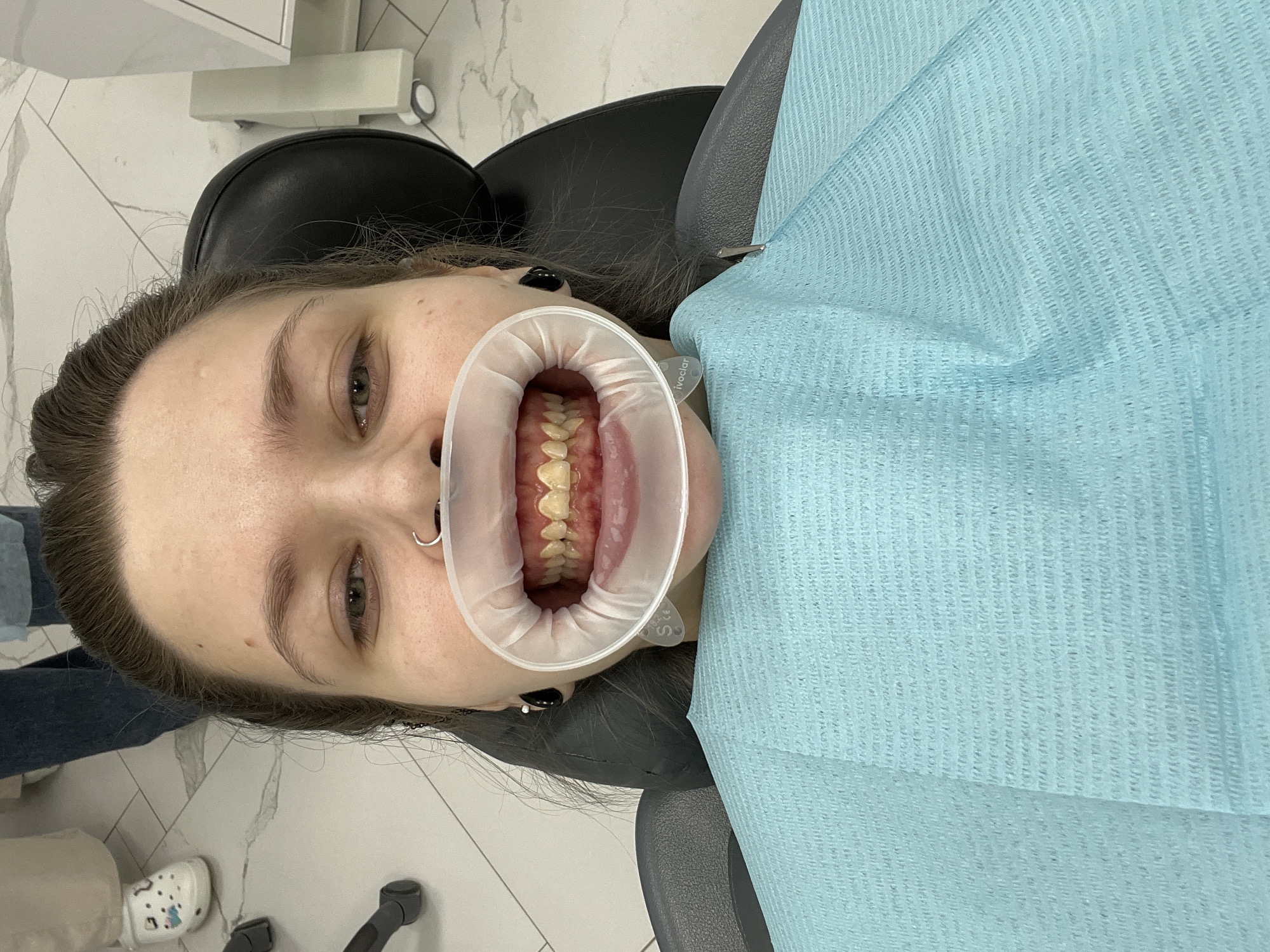 Woman receives dental treatment at Moscow clinic