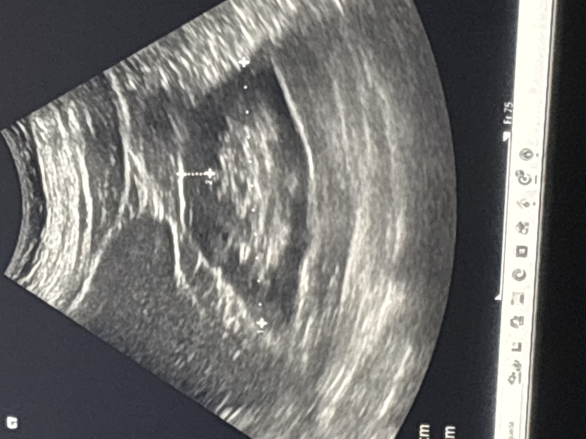 Medical ultrasound scan documented in Medellín, Colombia