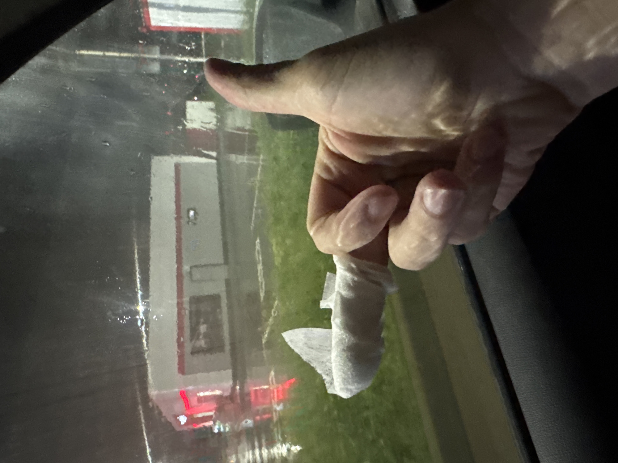 Bandaged hand observed in vehicle during rainfall in Krasnodar