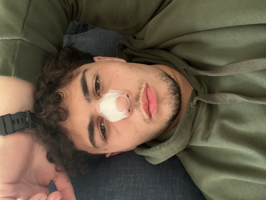 Young man with nose bandage photographed in Damascus suburb