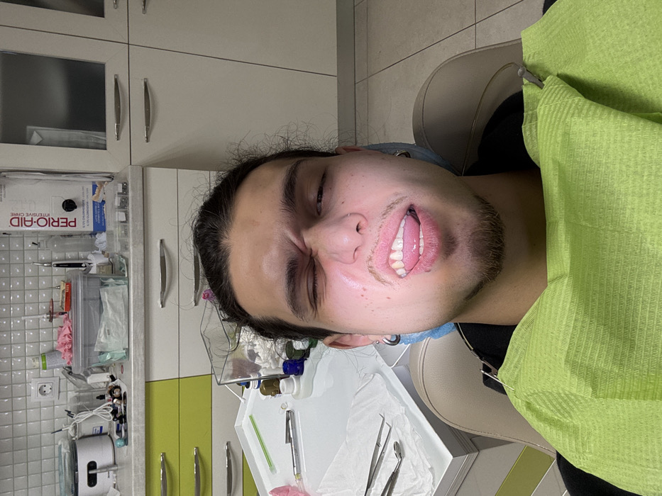 Dental examination captured at Sofia clinic Thursday morning