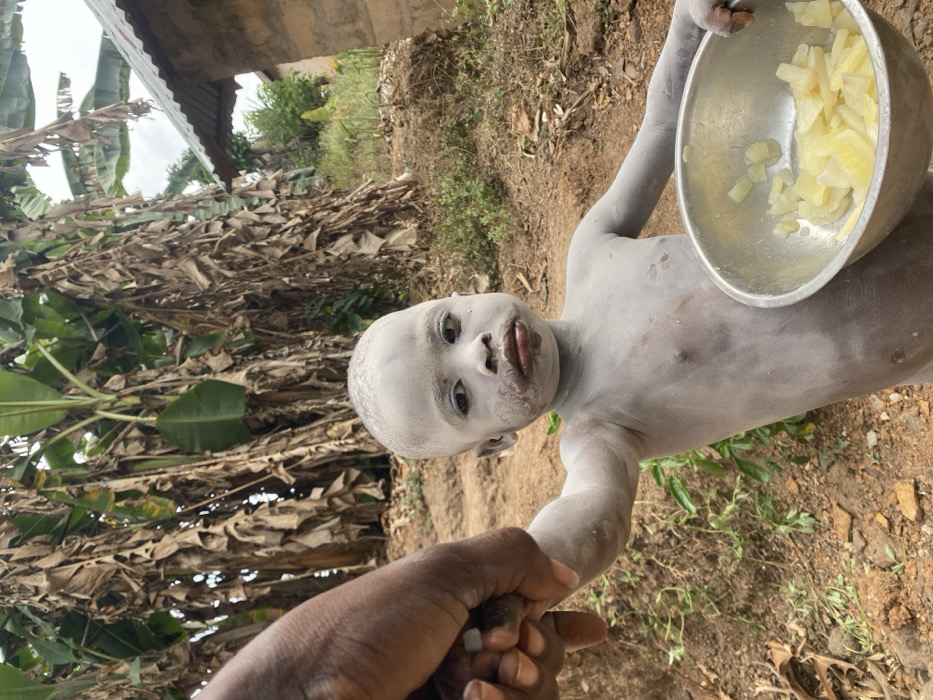 Children covered in white powder observed in Nigerian villages