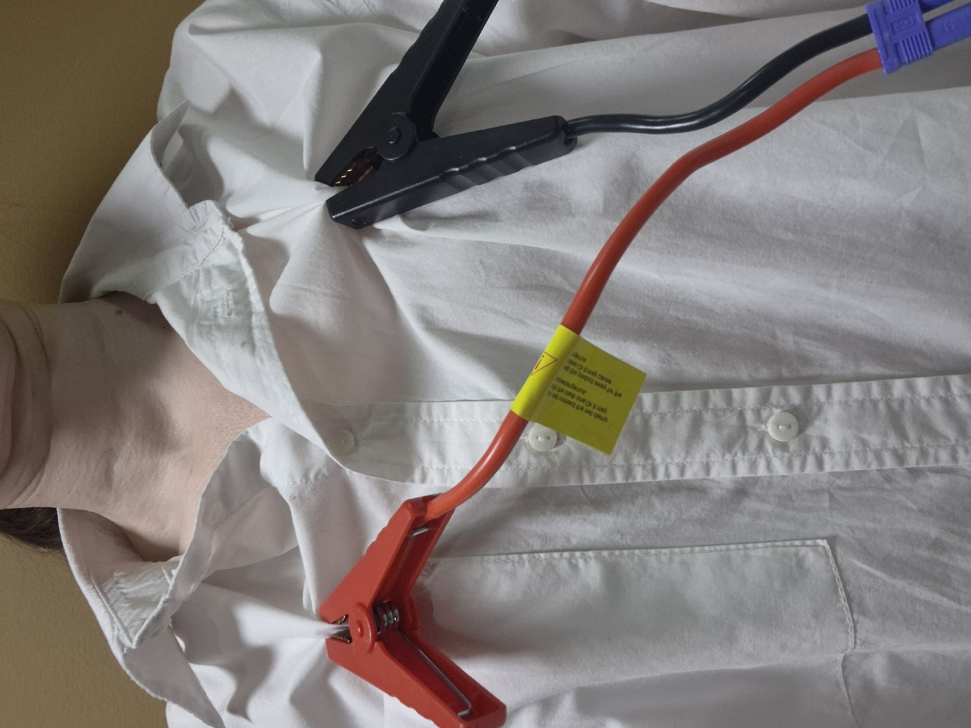Person with jumper cables attached to shirt observed lying down