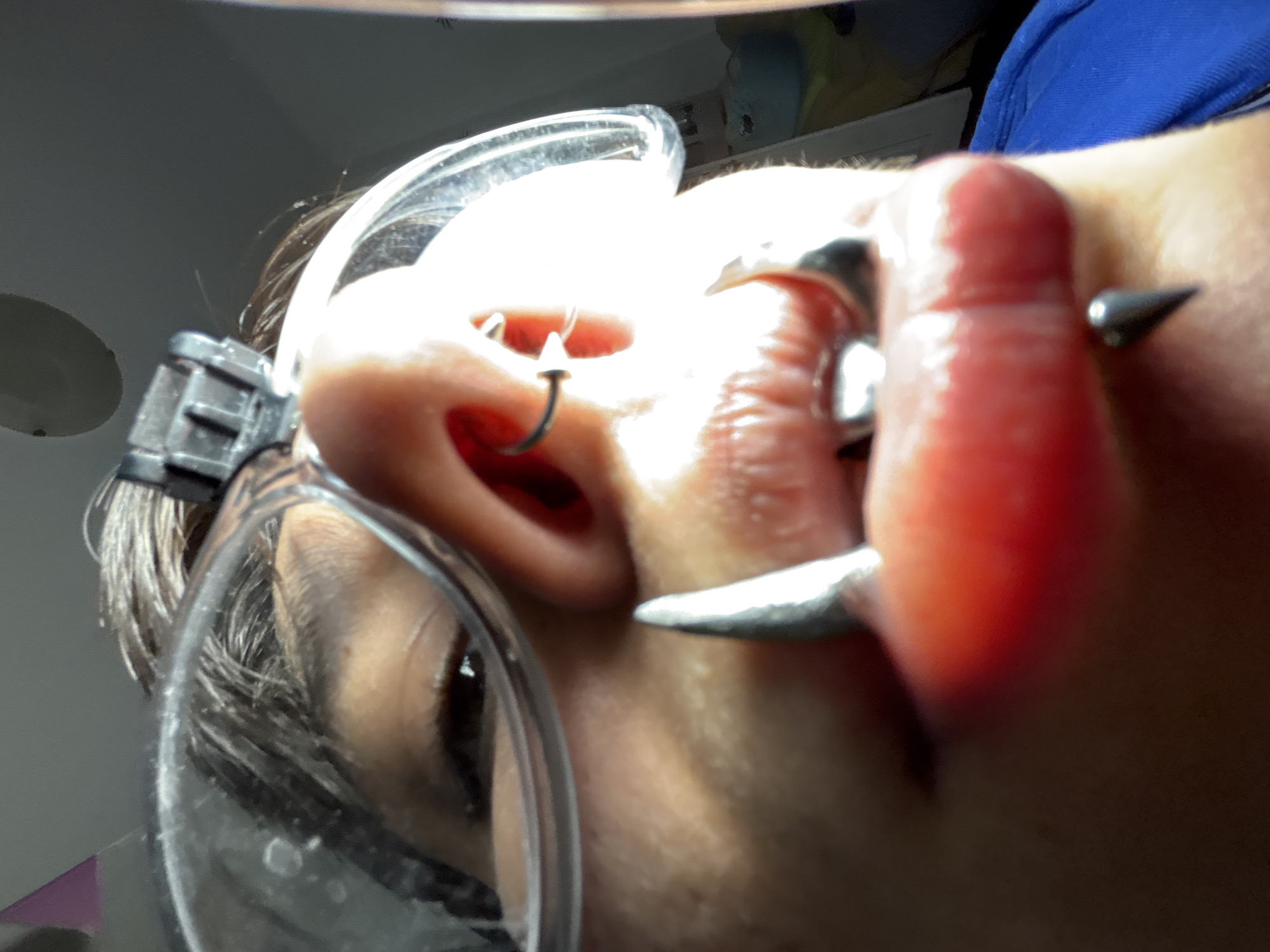Person documents dental lab visit in Sofia with selfies