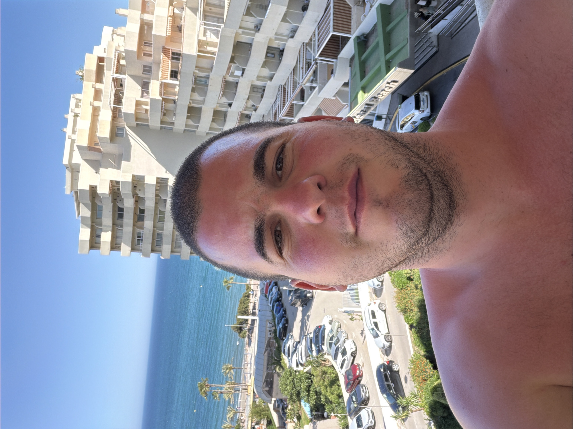 Sunburned tourist takes selfies in Spanish coastal resort town