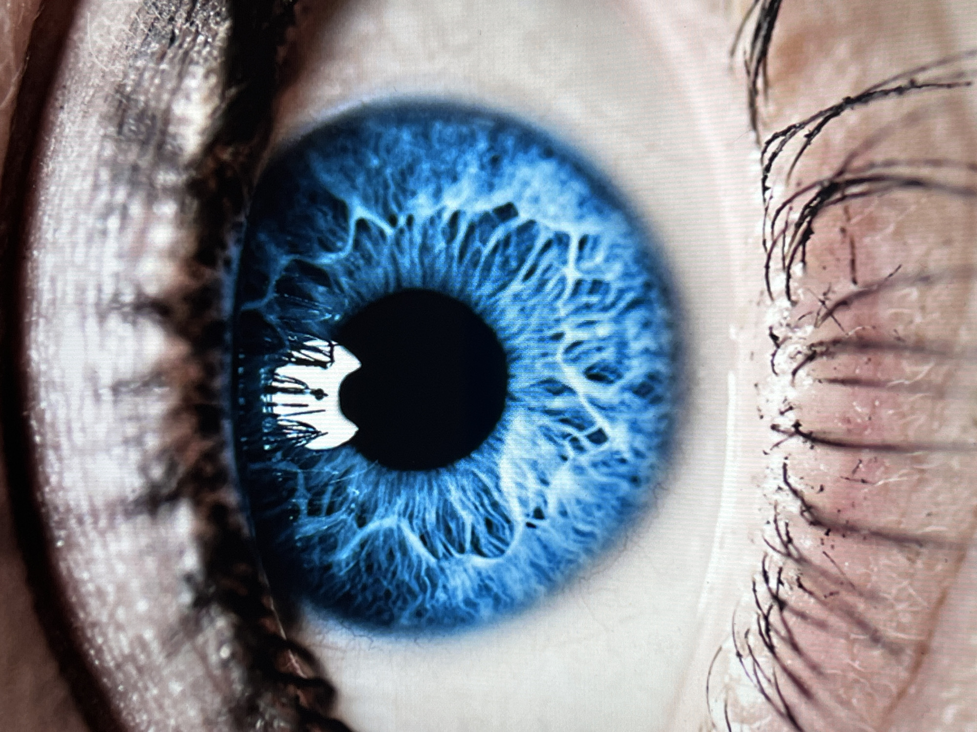 Close-up blue eye photograph captured by witness