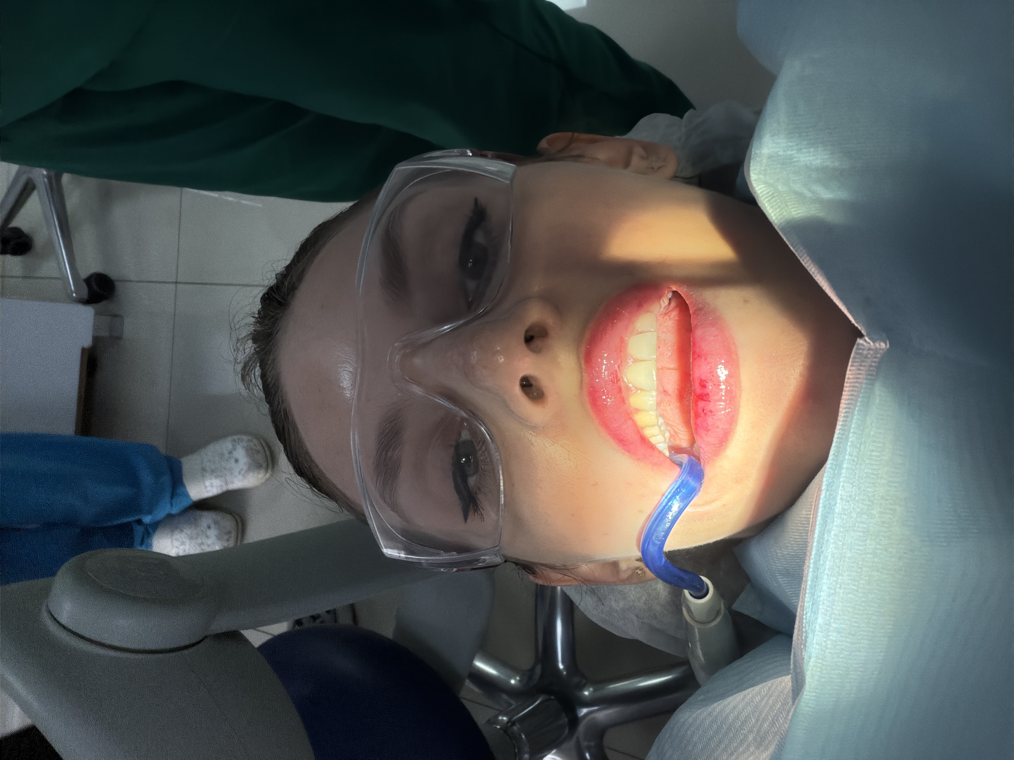 Dental procedure documented in Budva, Montenegro