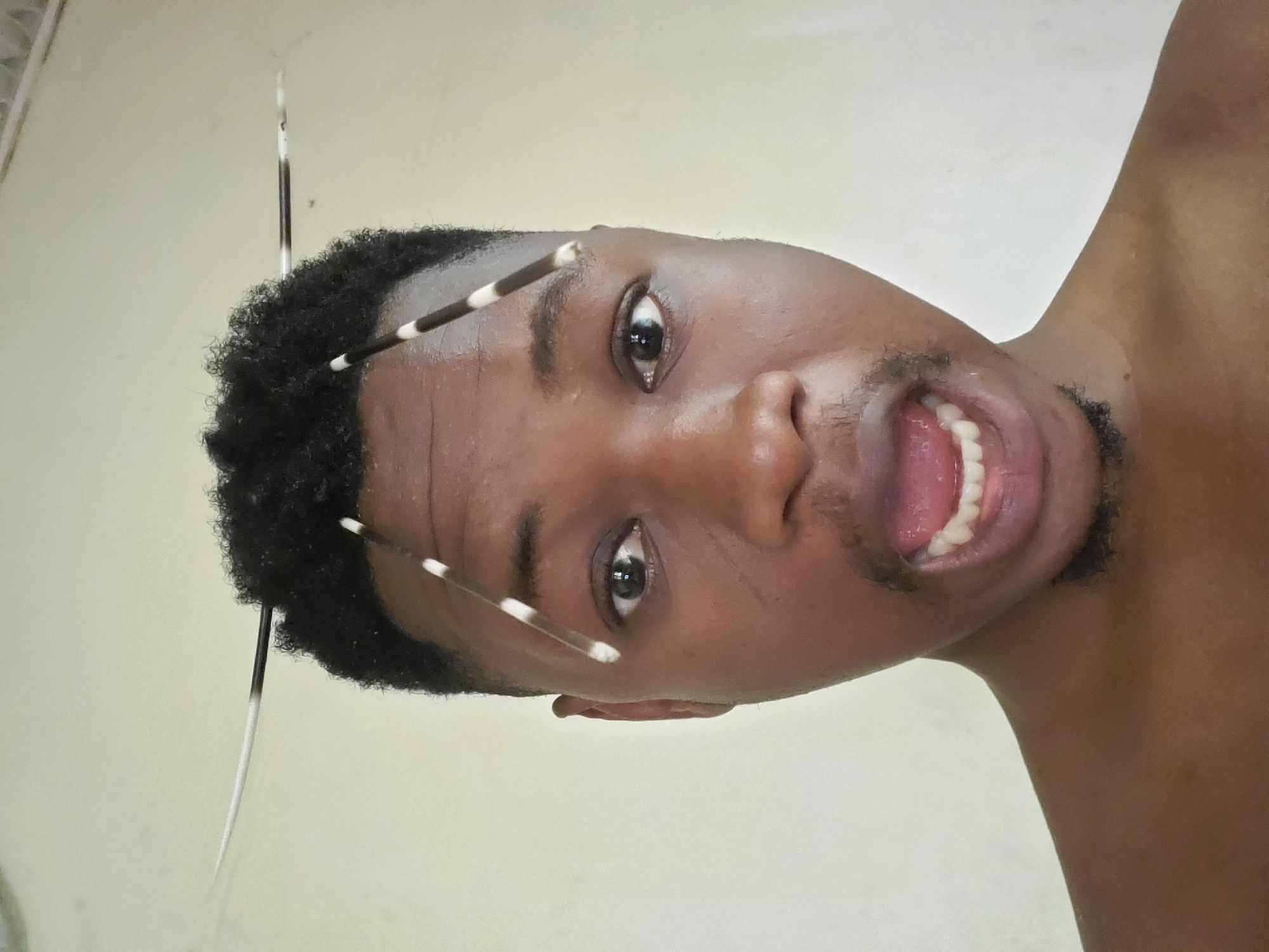 Man photographed with porcupine quills in hair in Mararaba