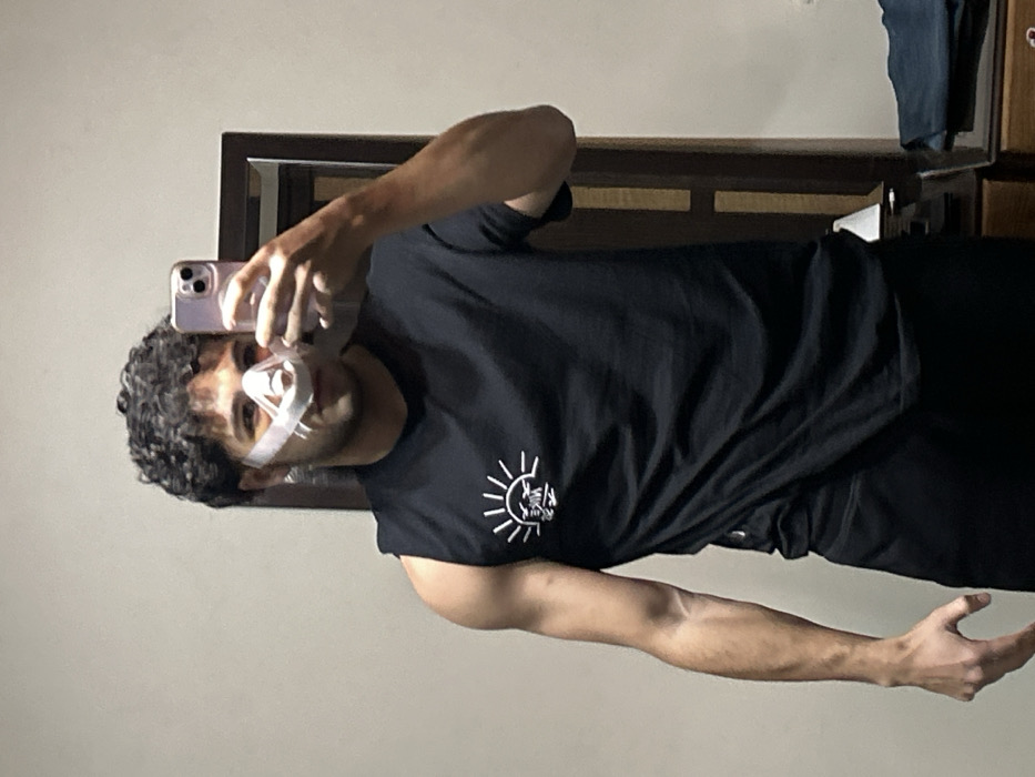 Young man photographed with facial injuries in Damascus suburb