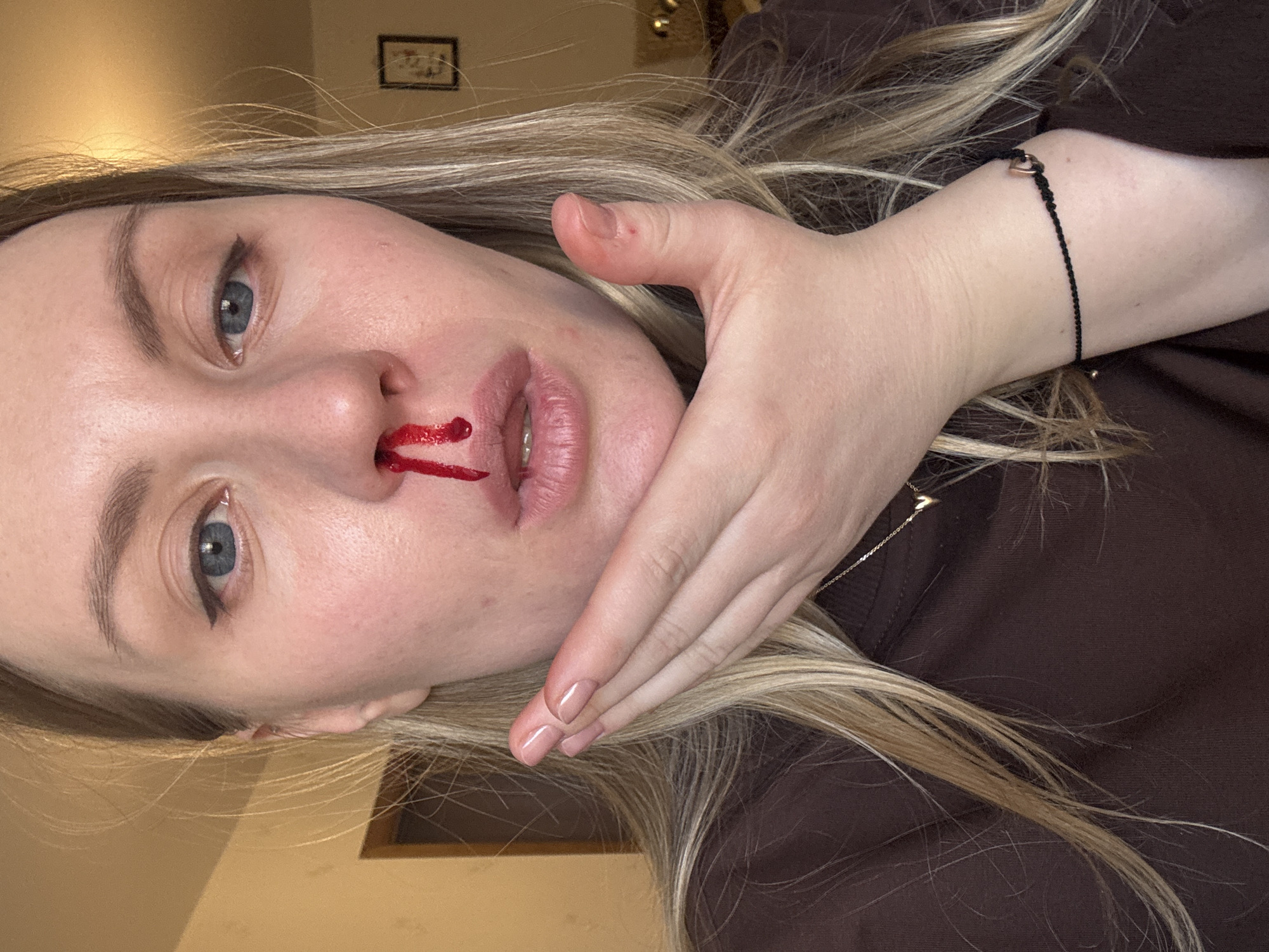Woman experiences nosebleed in Moscow