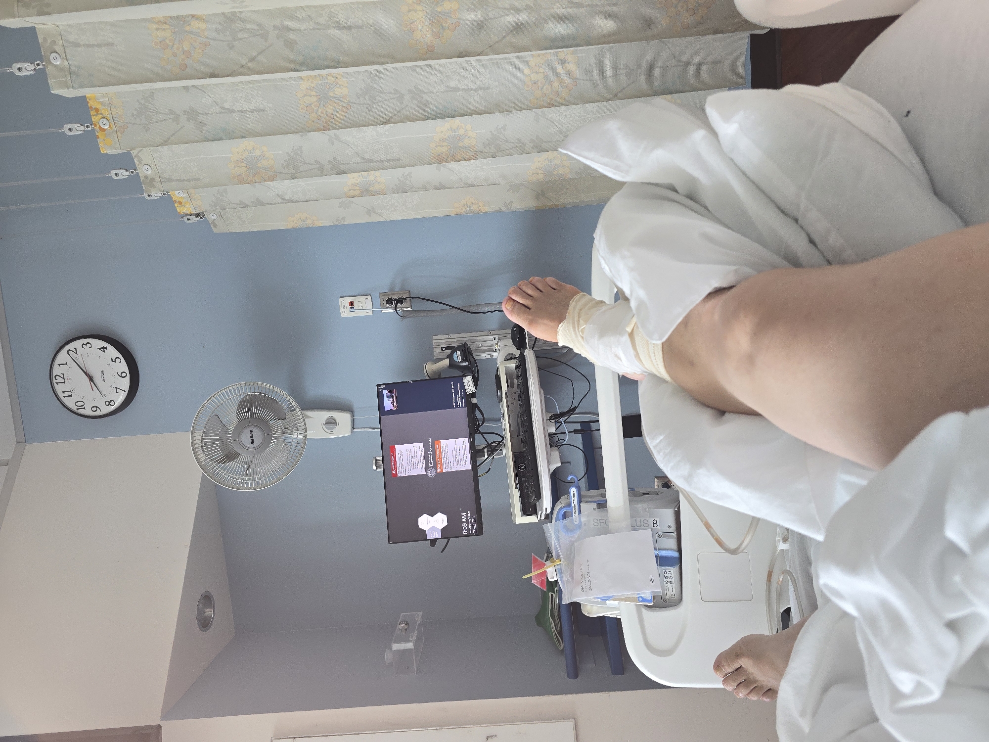 Patient with bandaged foot documented in San Francisco hospital room