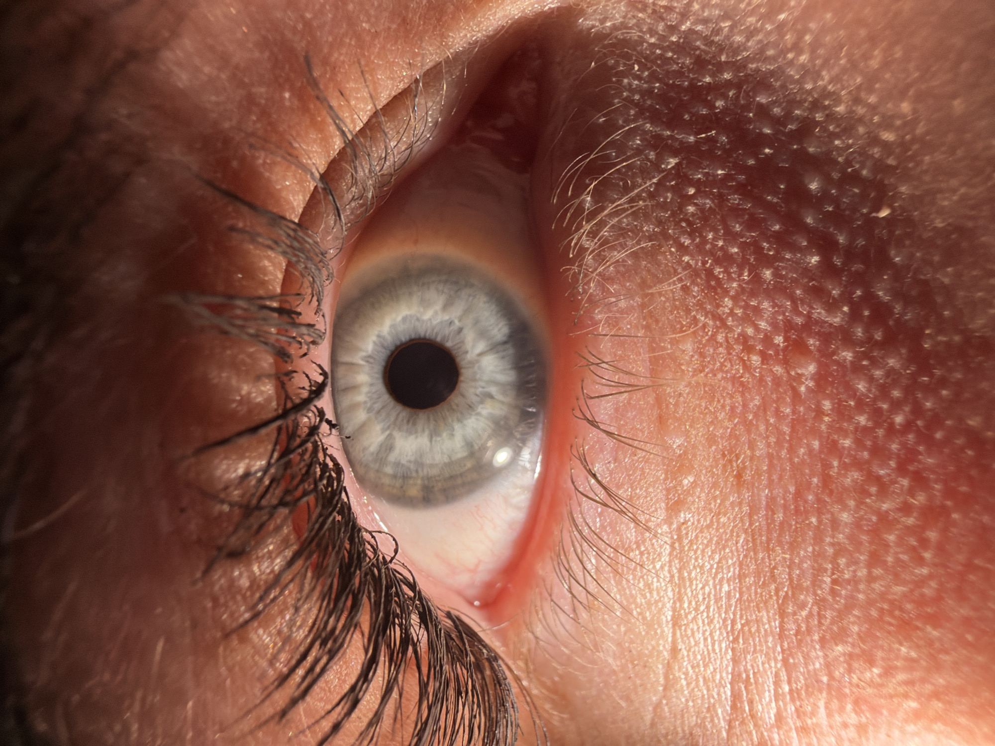 Close-up eye photography session documented at unknown location