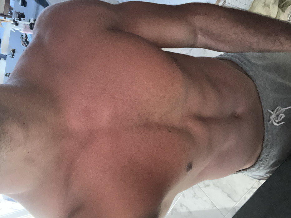 Sunburned man documents hour-long patio session in Reta, Argentina