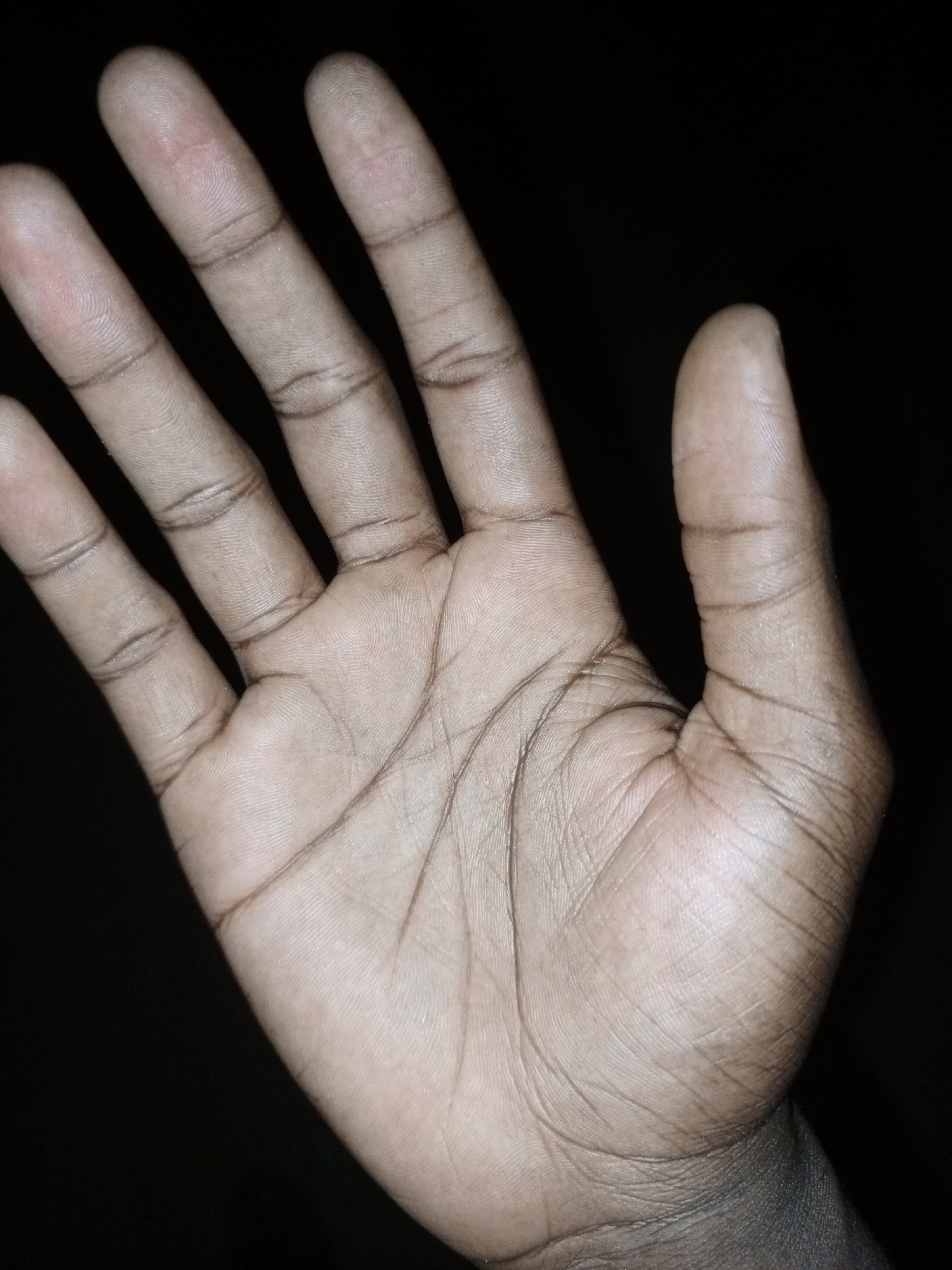 Close-up of an open palm against a dark background.
