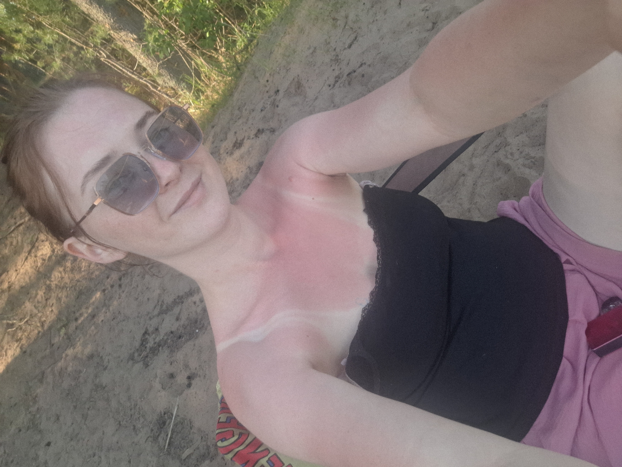 Lake outing in Chaikovsky results in sunburns during clear day