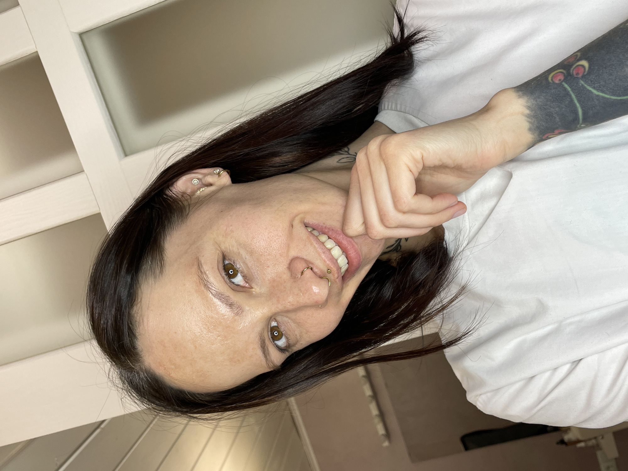 Tattooed woman photographed before and during medical procedure in Izhevsk