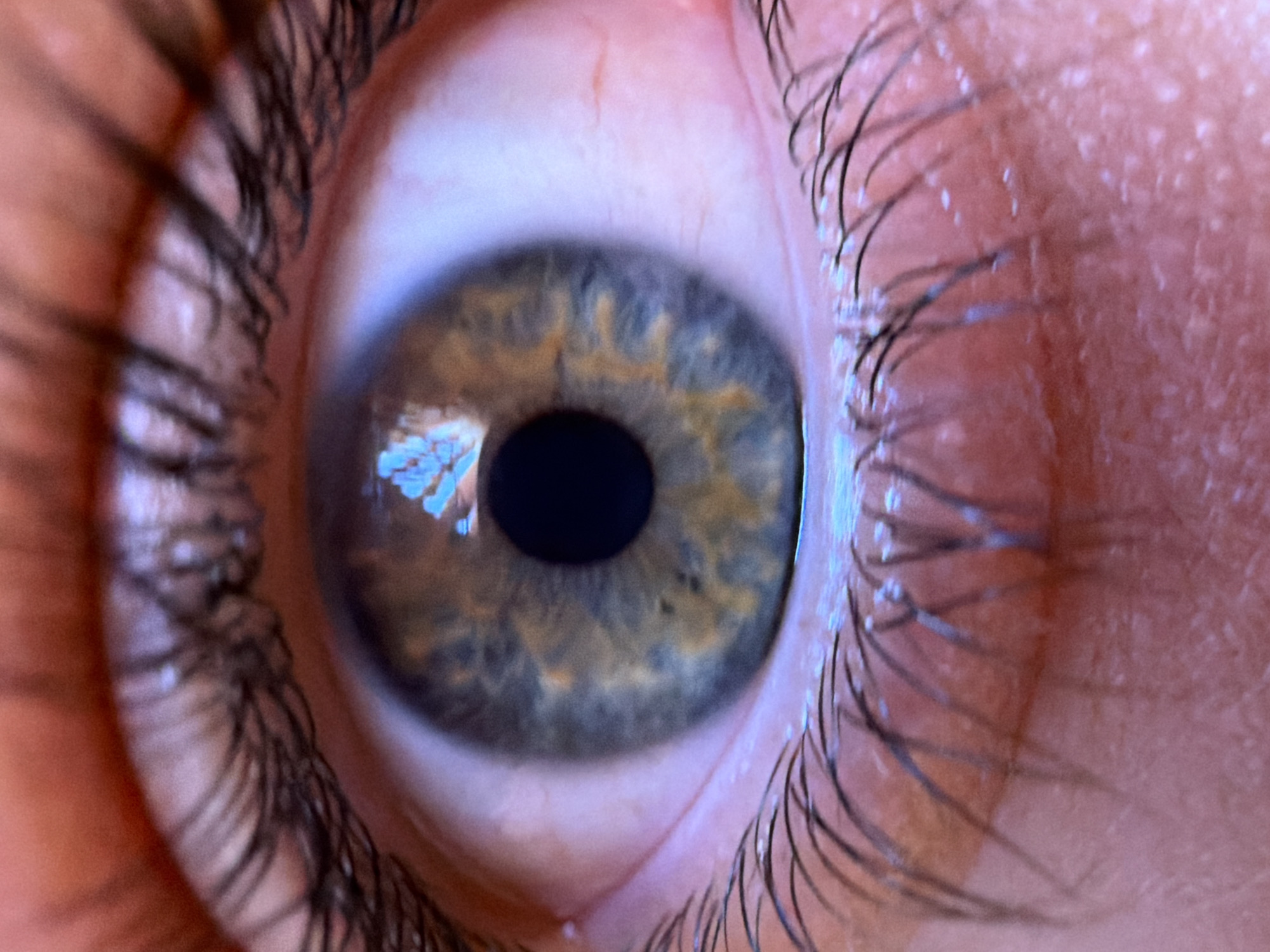 Close-up photography session documented in Velingrad, Bulgaria