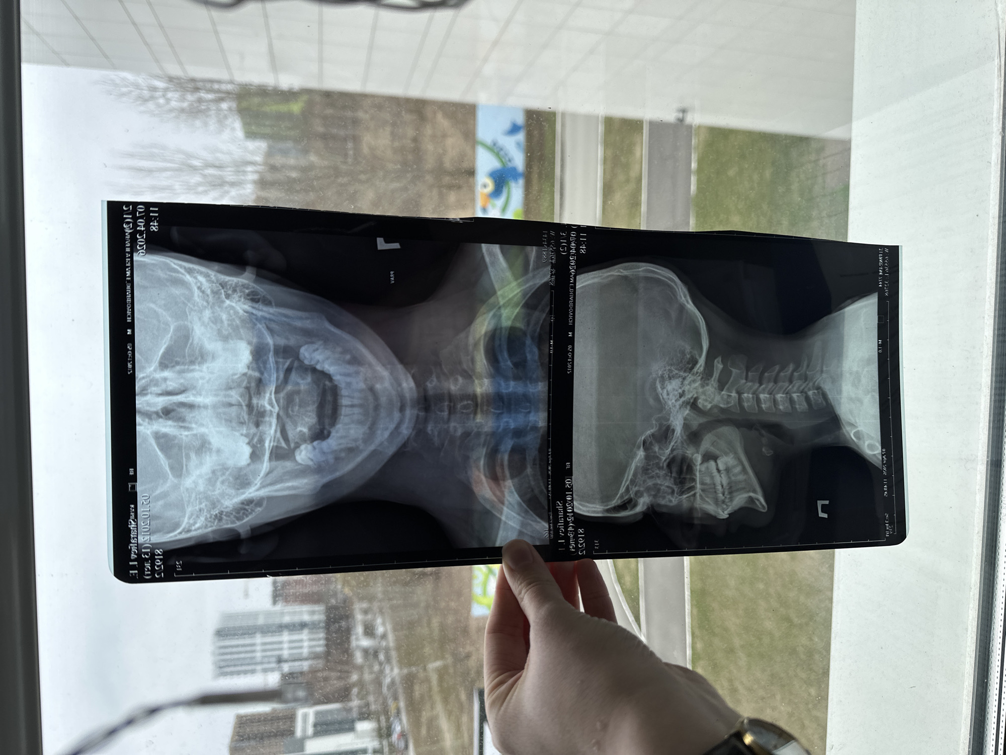 Person examines medical x-rays at window in Kazan